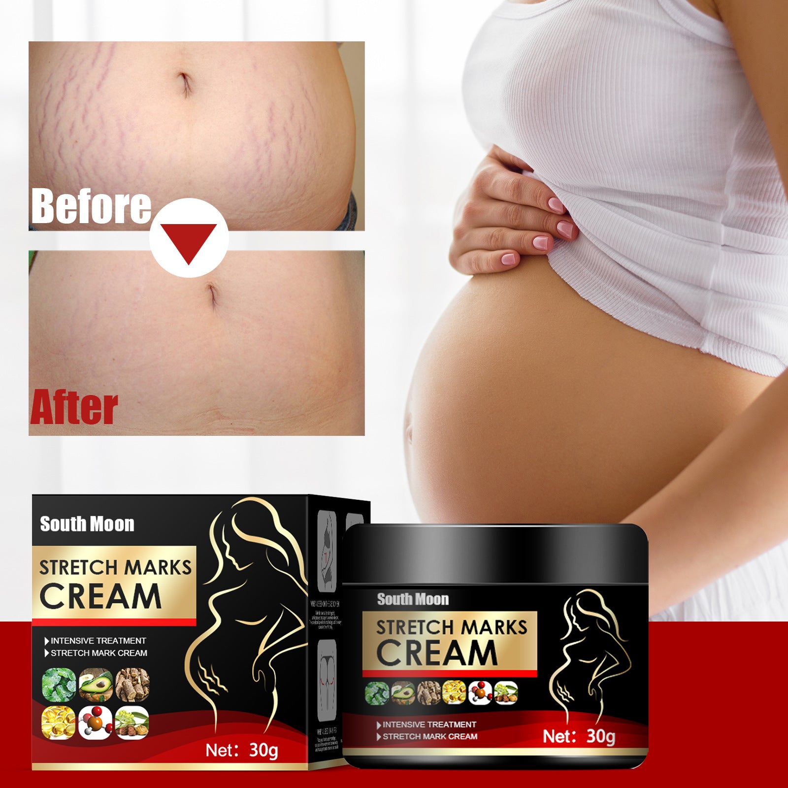 Crema Reparadora de Estrías Postparto