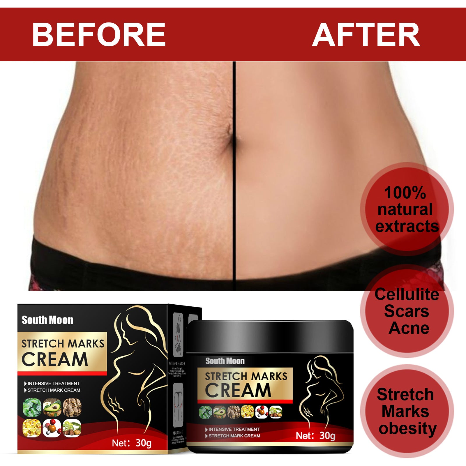 Crema Reparadora de Estrías Postparto