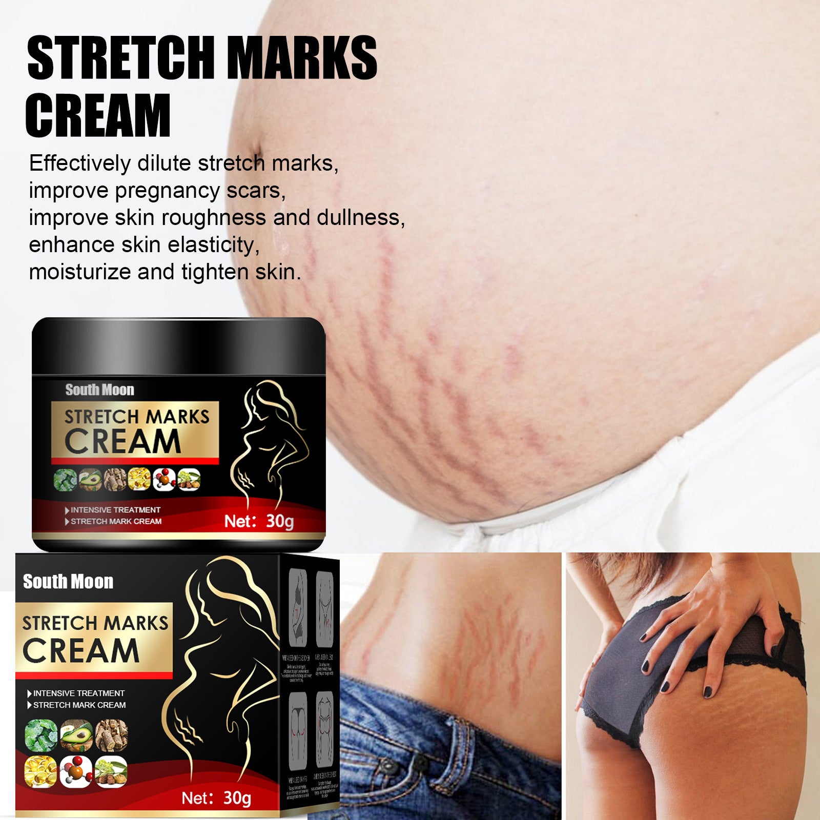 Crema Reparadora de Estrías Postparto