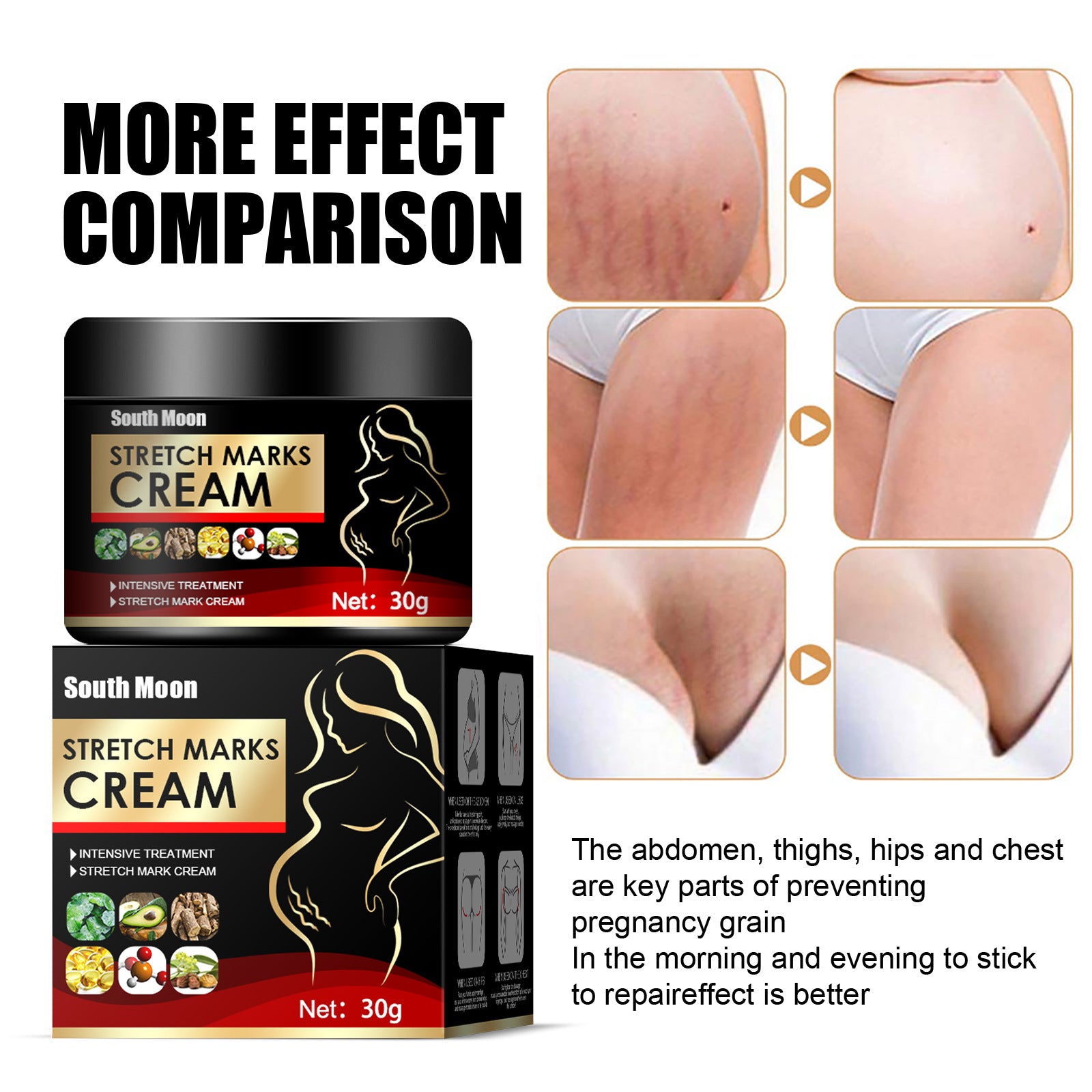 Crema Reparadora de Estrías Postparto